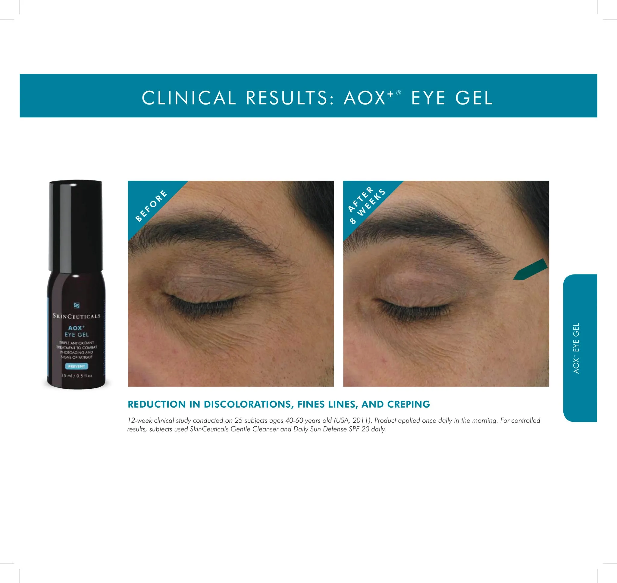 Aox  Eye Gel